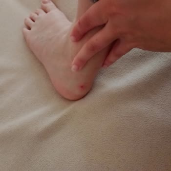 Puma Ayakkabı Ayağımı Vuruyor 2 Kere Giydim