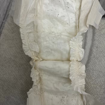 Sleepy Bebek Bezinde Siyah Lekeler Var