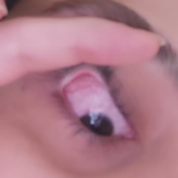 Lensoptik.com.tr Lens Optik Bozuk Lens Gönderimi