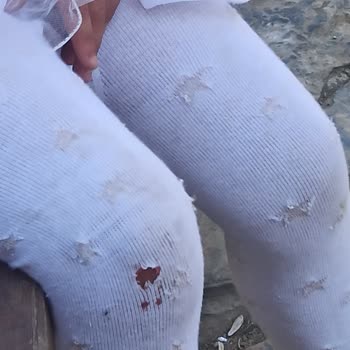 Üsküdar Belediyesi Park Çevre Zemin Ve Materyal Düzenlemesi