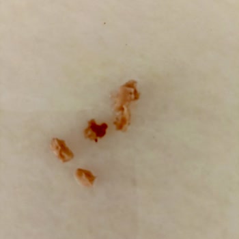 Gimsa Zincirleri Şikayet Kıyma Diye Ne Yiyoruz