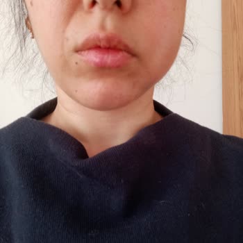 Tetradent Ağız ve Diş Sağlığı Polikliniği Acil Diş Ağrısıyla Başa Çıkamayan Poliklinik