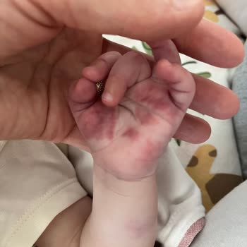 Denipol Hastanesi Kan Alma Sorunsalı