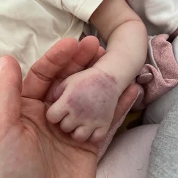 Denipol Hastanesi Kan Alma Sorunsalı