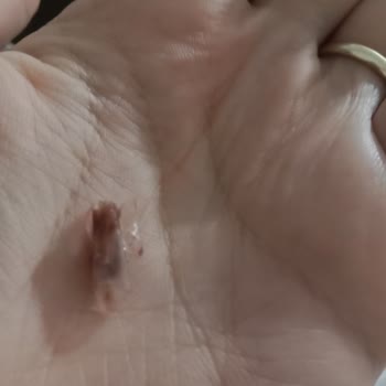 Dr. Oetker Puding Den Bant Çıktı