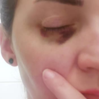 Luvimed Clinic Luvimed Bahcesehir İşlemi