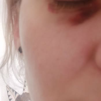 Luvimed Clinic Luvimed Bahcesehir İşlemi