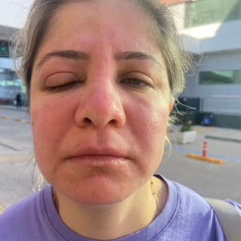 Procsin Ürün Memnuniyeti Sıfır