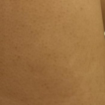 Wlab Selülit Krem Yakıyor