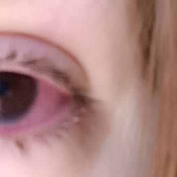 Lensfiyat.com Nk Lio Merlot Süresi Dolmuş Lens Satılması