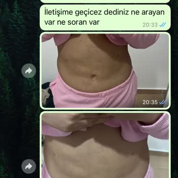 Vita Estetik Estetik Ameliyat Sonrası Yaşanan Sorunlar