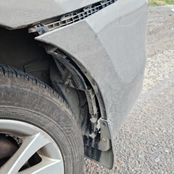 Toyota ALJ Toyota Servisindeki Bakım Sonrası Tampon Sorunu Ve Güvensiz Yolculuk