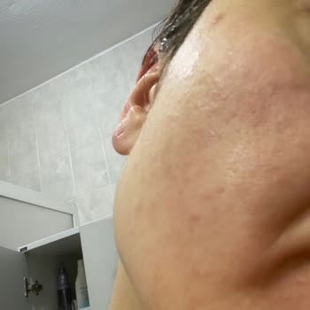 Yves Rocher Ürünleri Yüzümde Alerji Yaptı Ve İlgilenmiyorlar!