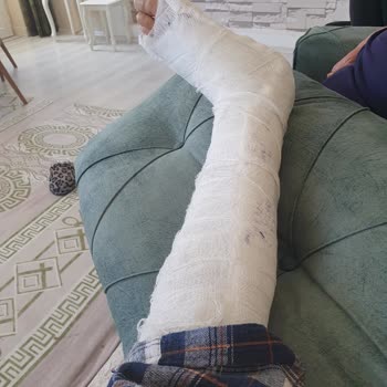 Axa Sigorta Tazminat Hakkımı Ödemiyor