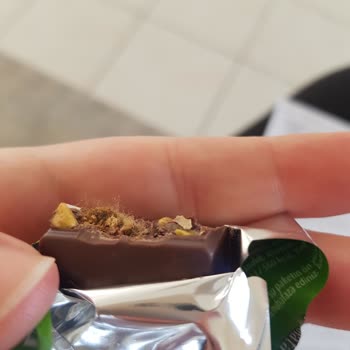 Eti Gıda Eti İçi Bol Antep Fıstıklı Çikolatadan Saç Çıktı