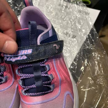 Skechers Işıklı Ayakkabı Soyulma Ve Yanmama