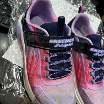 Skechers Işıklı Ayakkabı Soyulma Ve Yanmama