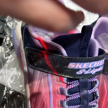 Skechers Işıklı Ayakkabı Soyulma Ve Yanmama