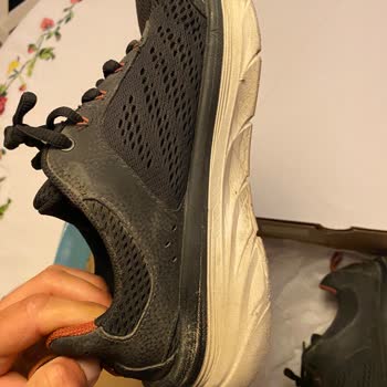 Skechers Malının Arkasında Durmuyor