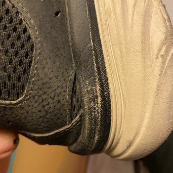 Skechers Malının Arkasında Durmuyor