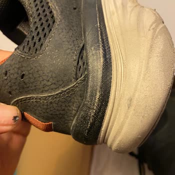 Skechers Malının Arkasında Durmuyor