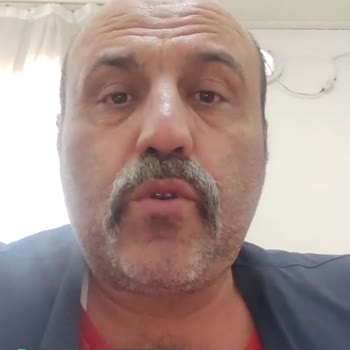 Xiaomi Redmi Note 10 Pro Arızası!