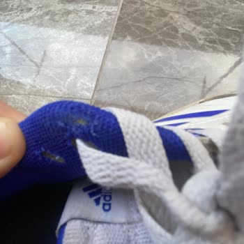 Boyner'den Adidas Ayakkabı Aldım Ve Yırtıldı Birkaç Ay İçinde