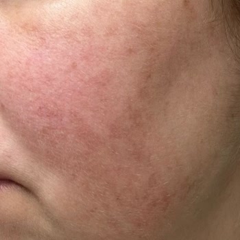 Dr. Güneş Ertürk Klinikte Yaşanan Tedavi Süreci Ve Sonrası Hakkında Değerlendirme