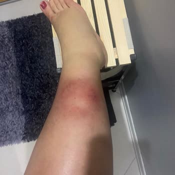 Climed Tedavi Merkezi Bağdat Caddesi Kılcal Damar