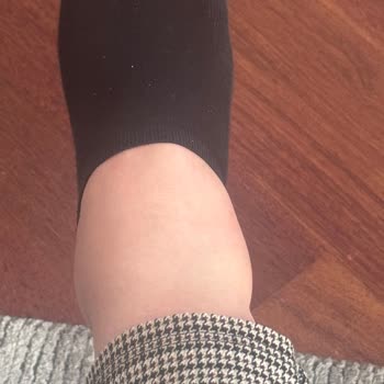 Climed Tedavi Merkezi Bağdat Caddesi Kılcal Damar