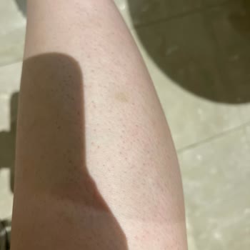 Estetik Land Lazer Şikayet Bildirimi