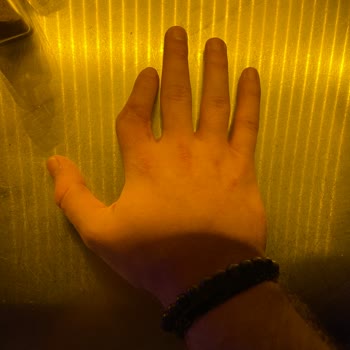 Kartal Dr. Lütfi Kırdar Şehir Hastanesi Doktor Parmağımı Sakat Bıraktı!