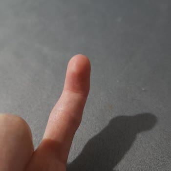 Özel Levent Hastanesi Ortopedi Bölümüne Git Meyin