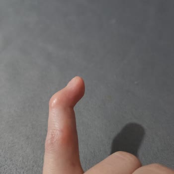 Özel Levent Hastanesi Ortopedi Bölümüne Git Meyin