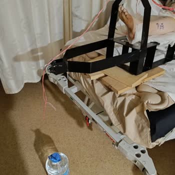 Marmara Üniversitesi Pendik Eğitim ve Araştırma Hastanesi Pendik'te Motorsiklet Kazası Sonrası Hastane Süreci Ve Yaşanan Zorluklar