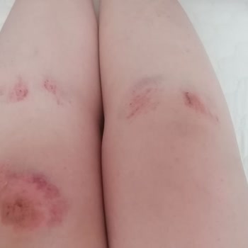 Marjin Ayakkabı Yeni Babetimle Üç Kez Düştüm!