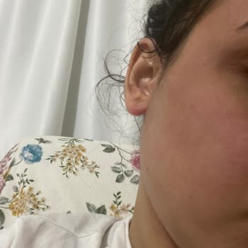 Gratis Bee Beuty Maske Şikayeti