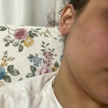 Gratis Bee Beuty Maske Şikayeti