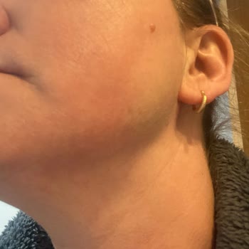 Yves Rocher Anti Global Serum Yüzde Kızarma Yanma