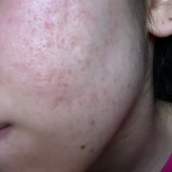 Watsons Cilt Bakım Ürünü Hayal Kırıklığı Ve İade Sorunu