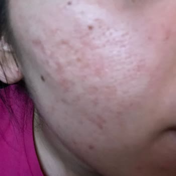 Watsons Cilt Bakım Ürünü Hayal Kırıklığı Ve İade Sorunu