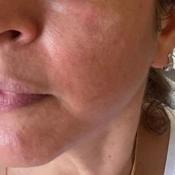 New Well Güneş Kremi Faciası