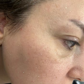 Yves Rocher Güneş Kremi İade