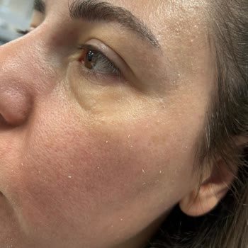 Yves Rocher Güneş Kremi İade