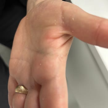 Yves Rocher Güneş Kremi İade