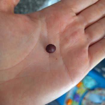 ebebek Yabancı Cisim Eksik İçerik