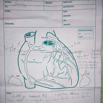 BNP Paribas Cardif Emeklilik Şikayetçi Olacağım. Nereye Şikayet Edebilirim. Neredeyse 3 Ay Olacak