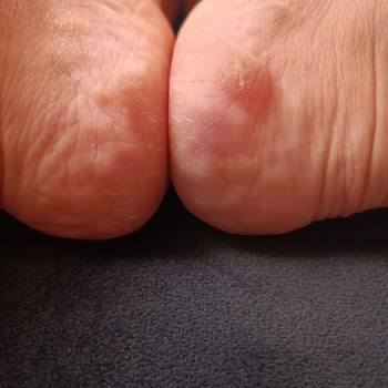 Asics Kayano 30 Topuk Vurma Sorunu