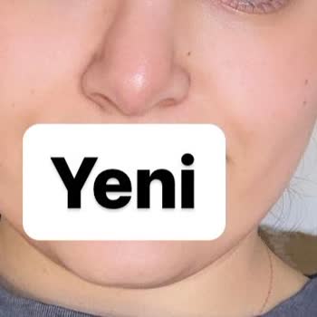 Ankara Bilkent Şehir Hastanesi Revizyon Rinoplasti Daha Kötü Burun