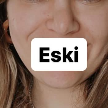 Ankara Bilkent Şehir Hastanesi Revizyon Rinoplasti Daha Kötü Burun